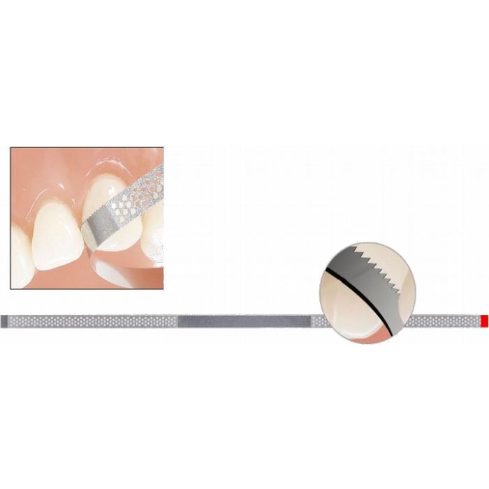 G392 Punta Diamantata Per FG Interprossimale (5 Unità) - DIATECH - Foto 5