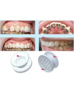 BOTTONI CERAMICA TRASPARENTI DB 10pz