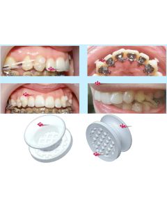 BOTTONI CERAMICA TRASPARENTI DB 10pz