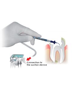 ENDO ASPIRATOR CERKAMED X 5PZ    (aspirazione dei trattamenti canalari.)