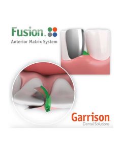 Fusion Anterior Matrix  Mini kit ANK02 e Kit ANK01 Garrison