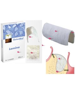 OSTEOBIOL LAMINA CORTICALE