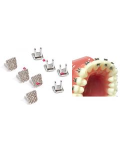 RiEducatori Linguali Spikes- 10pz.