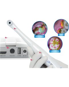 TELECAMERA INTRAORALE DETECT attacco HDMI VGA, 5 MP, luce blu, wi-fi